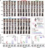 华裔学者脱发研究新进展：一种外泌体可促进小鼠毛发生长