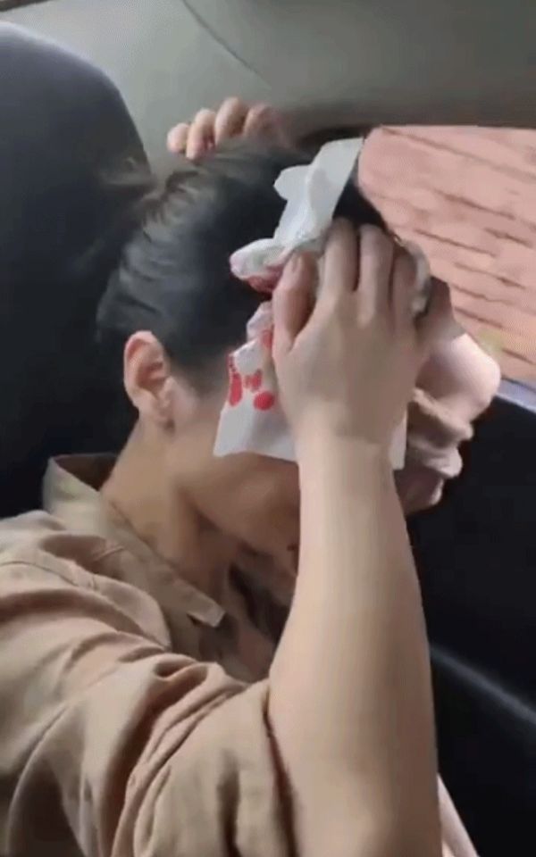 黄圣依受伤
