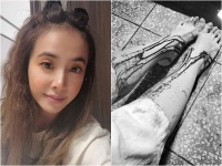 蔡依林晒“双腿流血照”超吓人 经纪人亲曝近况