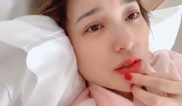 金莎嘴巴被手机砸伤