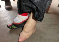 民国小脚夫人：靠小脚嫁富户，只有丈夫能看，每次洗脚都疼到崩溃