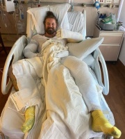 摇滚歌手在篝火事故中全身烧伤25% 裹绷带晒照