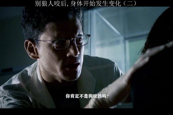被狼人咬后,身体开始发生变化
