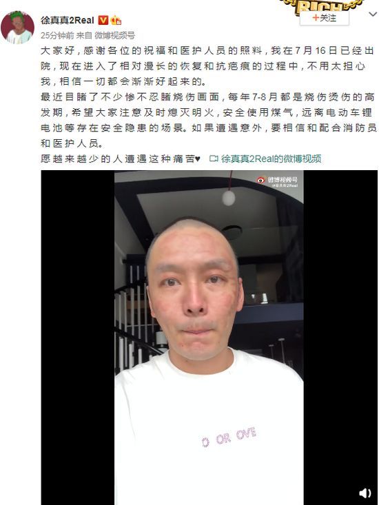 徐真真出院
