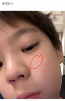 嗯哼晒自拍询问爸爸杜江:我不会长了青春痘了吧