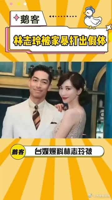林志玲被曝被老公黑泽良平家暴,假体疑似被打出?