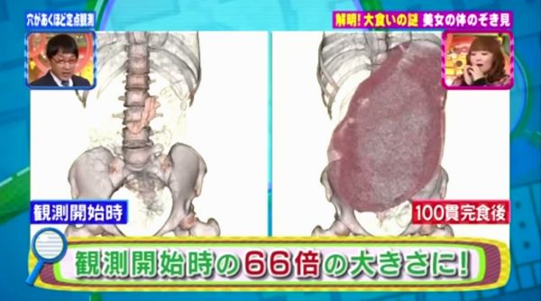 “大胃王”木下在吃过100个寿司后,通过映像检查发现胃部面积比进食前大了66倍(截图:生命时报)
