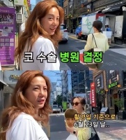 韩国女星承认鼻子手术,费用是一辆中级轿车价格,几个月不能喝酒