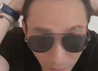 汪小菲直播罕提大S 戴墨镜眼角缝针被猜测整容