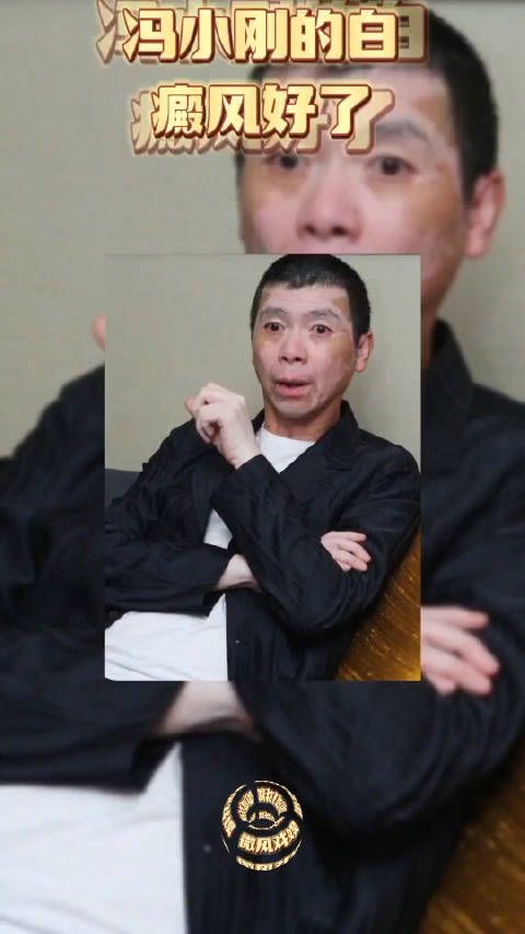 大导演冯小刚登上热搜,因为有眼尖的网友发现,冯小刚的白癜风……