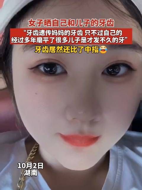 女子晒自己和儿子的牙齿,牙齿遗传妈妈的牙齿……