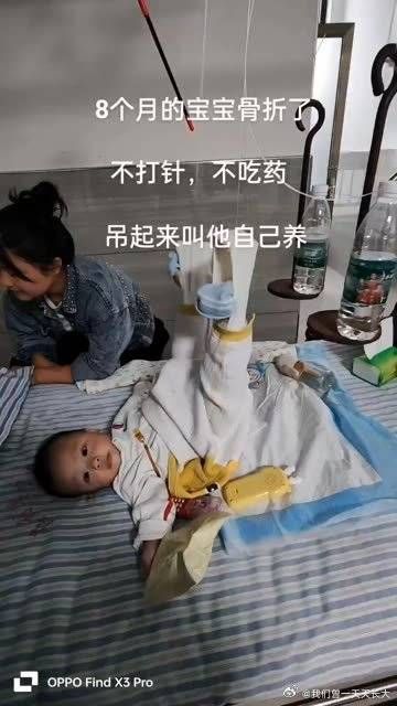 8月的宝宝骨折了,不打针不吃药,吊起来叫他自己养