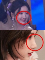 她鼻子怎么和以前不一样了？