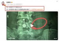 沈梦辰，已确诊？