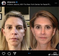 现在的医美已经进化到这种程度了……