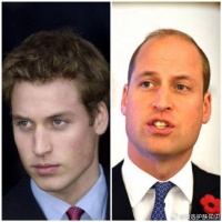 几十年过去了，威廉变化的不仅仅是头顶 还有他的眼神