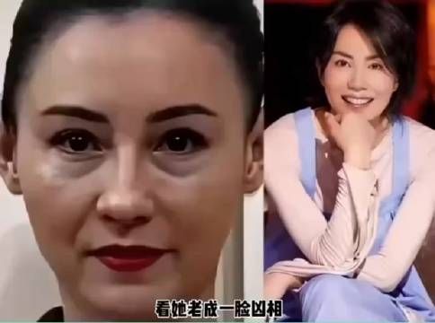 张柏芝一夜之间老成这个样子！