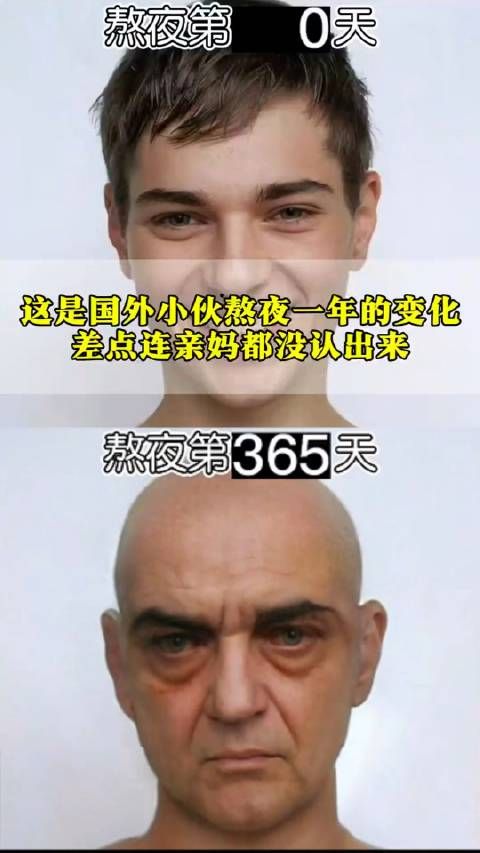 这是国外小伙熬夜一年的变化,差点连亲妈都没认出来