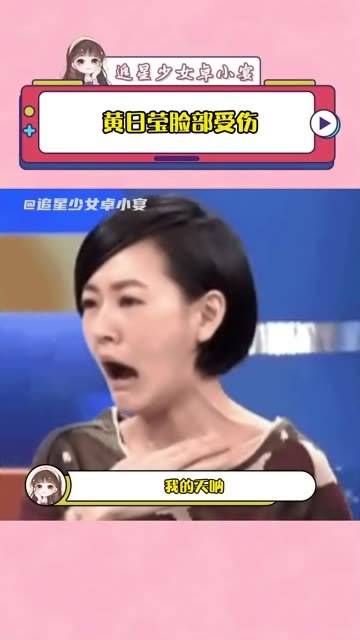 脸部受伤,听着都觉得疼!黄日莹 黄日莹