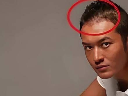 一张高清照片的公开,揭示了黄晓明多年来的身体秘密…