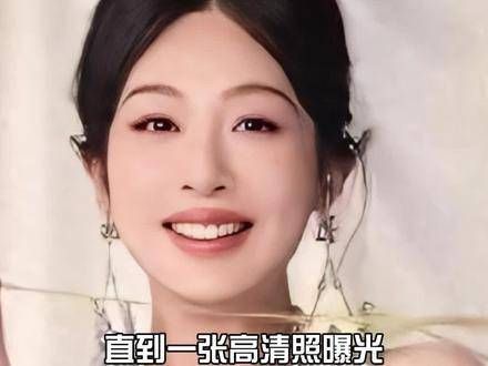 为何杨紫的脸变得如此“独特”?