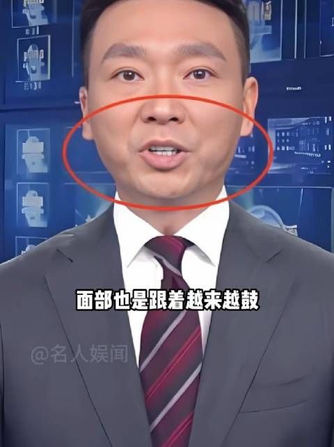 为何康辉面部越来越鼓?本以为是中年发福,真相曝光才知背后心酸