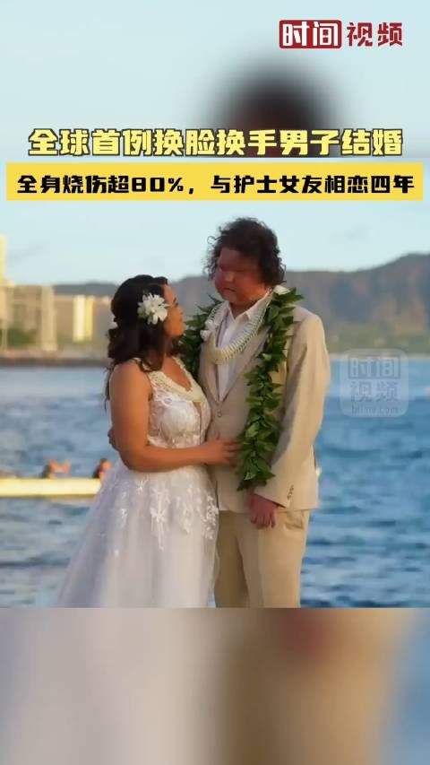 全球首例换脸换手男子结婚:全身烧伤超80%,与护士女友相恋四年