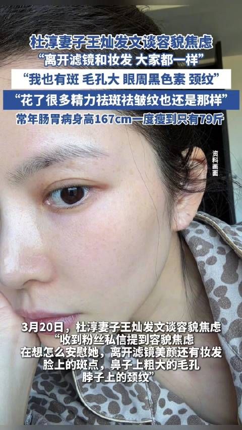 杜淳妻子王灿发文谈容貌焦虑