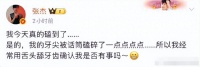 张杰开演唱会太投入 竟用话筒将自己的牙磕碎了!