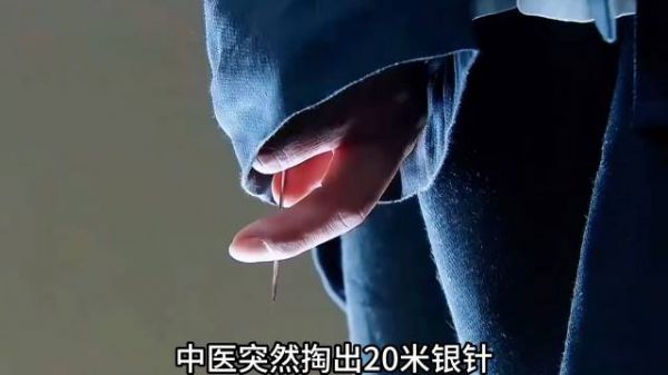 中医用一根针就治好了男人的并