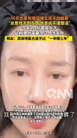36岁女星张檬自曝生孩子后脑雾 “总是找不到东西”