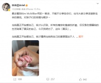 林依晨生二胎后首晒宝宝小手：与大家分享迎接新生命的喜悦