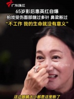 65岁影后惠英红自爆拍戏受伤经历，鼻梁断裂：“不工作，我的生命就没有意义”