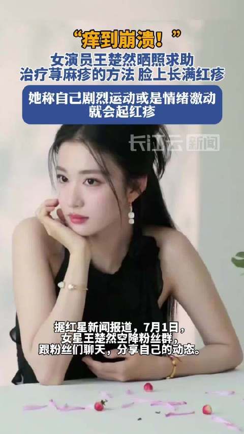 “痒到崩溃”!知名女演员晒照求助,网友大呼感同身受:太难受了