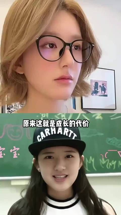 赵露思五年颜值变化,从婴儿肥到被质疑整容,背后经历了多少心酸