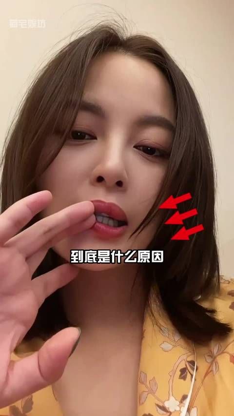 明明早年好端端的,为何辛芷蕾的嘴唇越来越厚?真相曝光才知是女星的爆红之路