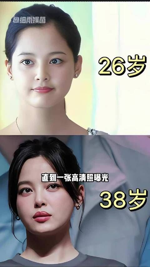 辛芷蕾三瓣唇高清照曝光，与孙俪殷桃同框引热议