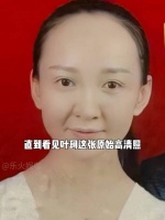 叶珂整容前照片曝光，真丑