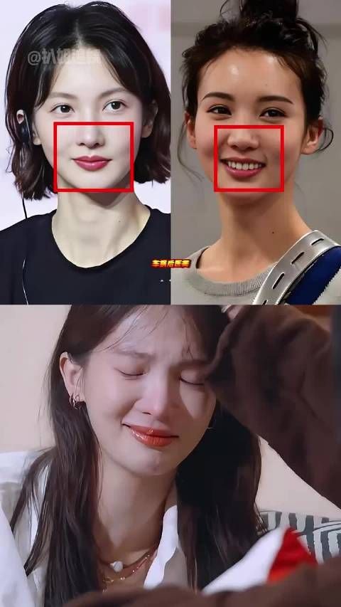为何金晨的鼻子越来越歪？看到她车祸面部受伤，才懂明星被迫医美背后有多心酸