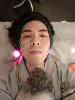 萧敬腾陪老婆林有慧针灸 脸上扎针数量超五十支