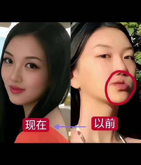 李嫣微整后神似王菲，遗传母亲清冷美艳气质