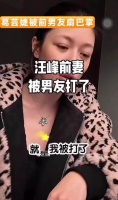 葛荟婕接连遭遇男友施暴摔伤