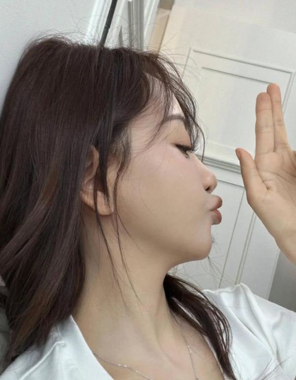 杨蓉面部烫伤恢复近照曝光。