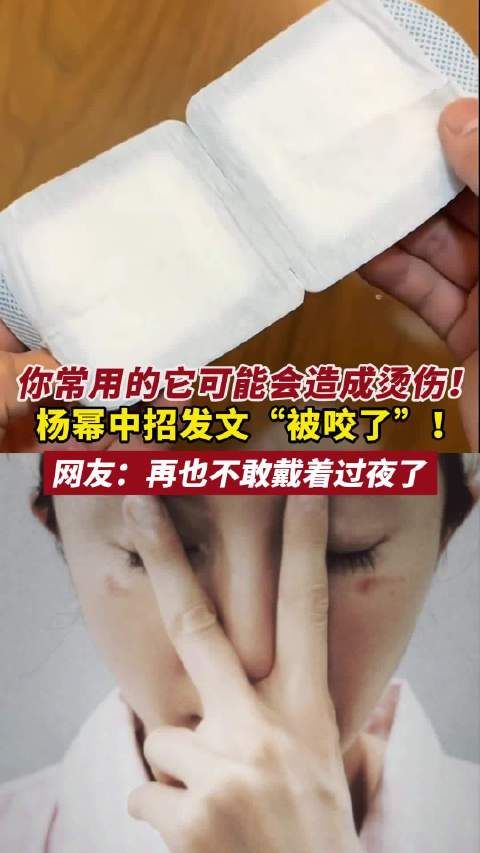 杨幂发文称被暖宝宝烫伤，网友提醒慎用过夜