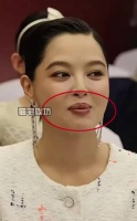 辛芷蕾嘴唇变化真相曝光