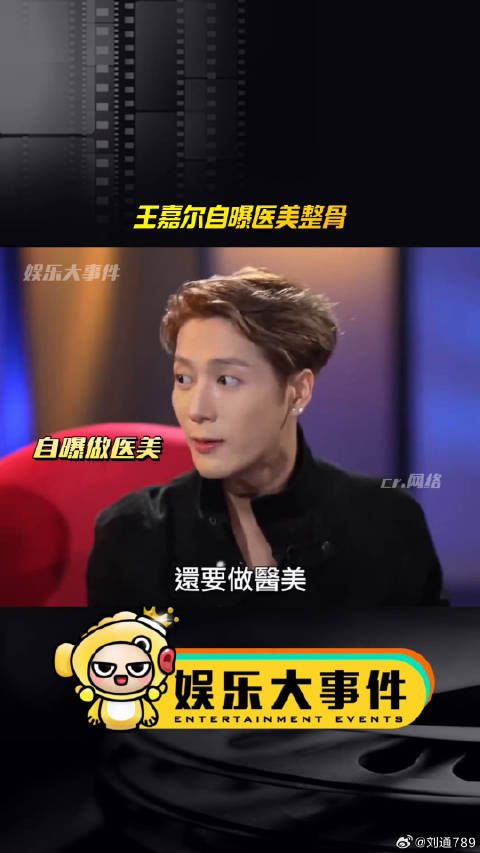 王嘉尔自曝30岁后做医美,韩国整骨一天健身两次