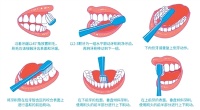 牙周病：“难以启齿”源于长期忽视