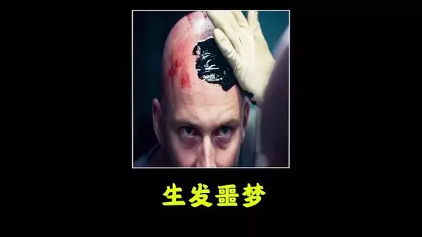 为长出头发猛涂生发液，三小时后头皮长出脓包