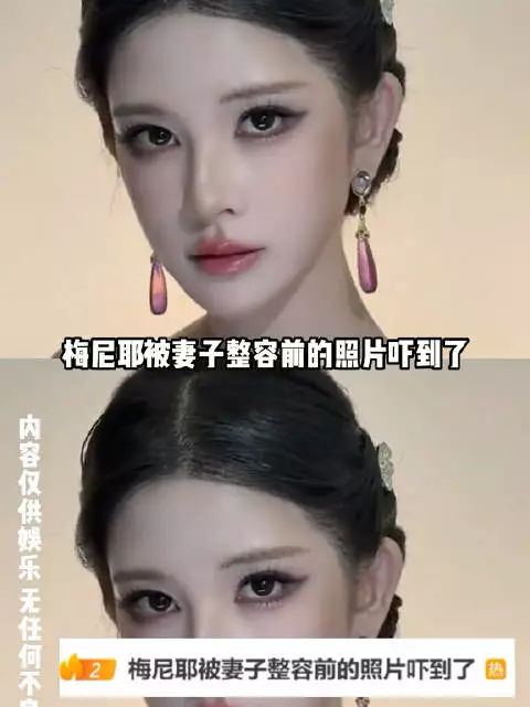 梅尼耶被妻子整容前的照片吓到了